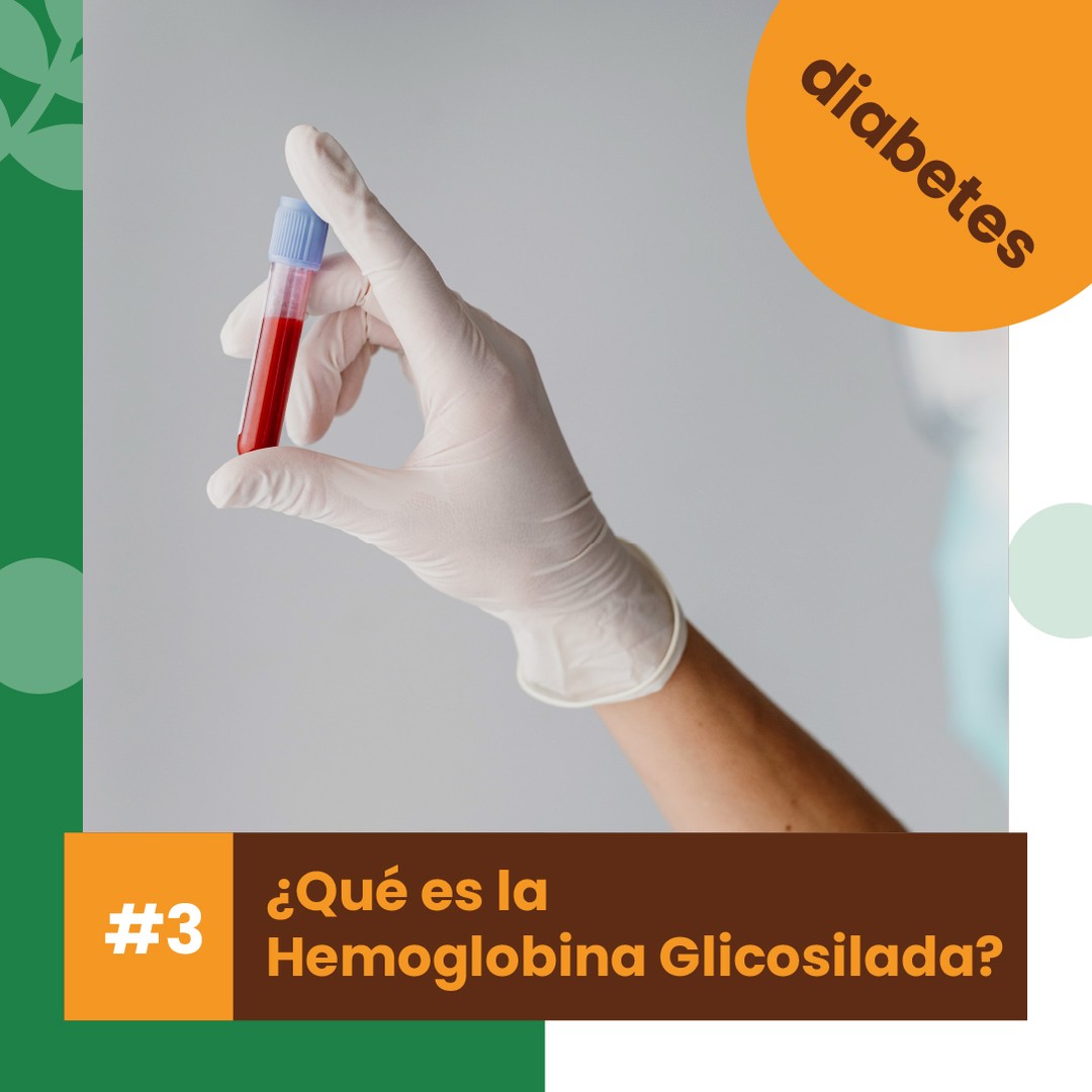 👉 La hemoglobina glicosilada es un examen de sangre que se les ordena a los pacientes diabéticos para medir sus niveles de azúcar en sangre en los últimos DOS MESES.

📄 Es decir si me hago un examen de sangre de glucosa hoy, me mide que comí ayer… si me hago un examen de sangre de hemoglobina glicosilada hoy, me mide que comí en los últimos DOS MESES… es decir es más real, más verídica, pues sí se que mañana me hare de glucosa, puedo portarme bien comiendo correctamente hoy, para que mañana no me salga alta la azúcar… pero cuando me hago glicosilada, la verdad sale a flote y me dice en mi cara como me he portado en los últimos dos meses; pues mide los niveles de azúcar en las últimas semanas.

⚠ 👉 El valor ideal normal es un resultado menor a 5.7 de glicosilada, de 5.7 a 6.4 es prediabetes es decir tienes un pie en la normalidad y otro pie dentro de la diabetes… y mayor a 6.5 es diabetes; entre más alto esté el valor más MAL te has portado comiendo lo que no debes.

Tu eres el que decides lo que voluntariamente te metes en la boca, con tu cuchara y con tu mano. 🥄 🤲

Porque lo natural siempre ha sido mejor, ❤yo amo lo natural❤ sin efectos químicos en mi cuerpo, pedidos directos al whatsapp 6062-0101
.
Judith Jurado Naturista y Psicóloga 👩‍💼
.
.
#diabetes #piediabetico #cegueradiabetica #hemoglobinaglicosilada #riñonesdiabeticos #tiposdiabetes #comidadiabetes #alpiste #cromo #insulina #glucosa #azucarensangre #diabetesmellitus #saludfisica #tipsdesalud #salud #botanica #medicinanatural #hierbas #sinquimicos #yoAMOlonatural #farmaciaonline #SantoRemedioPanama #JudithJuradoNaturistayPsicologa